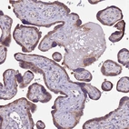 Immunohistochemical staining of human placenta shows weak cytoplasmic positivity in trophoblastic cells.