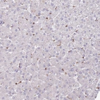 Immunohistochemical staining of human liver shows no positivity in hepatocytes as expected.