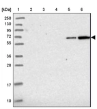 Lane 1: Marker [kDa] 250, 130, 95, 72, 55, 36, 28, 17, 10_br/_Lane 2: Human cell line RT-4_br/_Lane 3: Human cell line U-251MG sp_br/_Lane 4: Human plasma (IgG/HSA depleted)_br/_Lane 5: Human liver tissue_br/_Lane 6: Human tonsil tissue