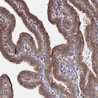 Immunohistochemical staining of human fallopian tube shows strong cytoplasmic positivity in glandular cells.