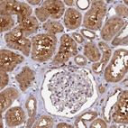 Immunohistochemical staining of human kidney shows strong cytoplasmic positivity in cells in tubules.