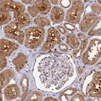 Immunohistochemical staining of human kidney shows strong cytoplasmic positivity in cells in tubules.