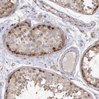 Immunohistochemical staining of human testis shows moderate cytoplasmic positivity in cells in seminiferous ducts.