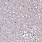 Immunohistochemical staining of human liver shows no positivity in hepatocytes as expected.