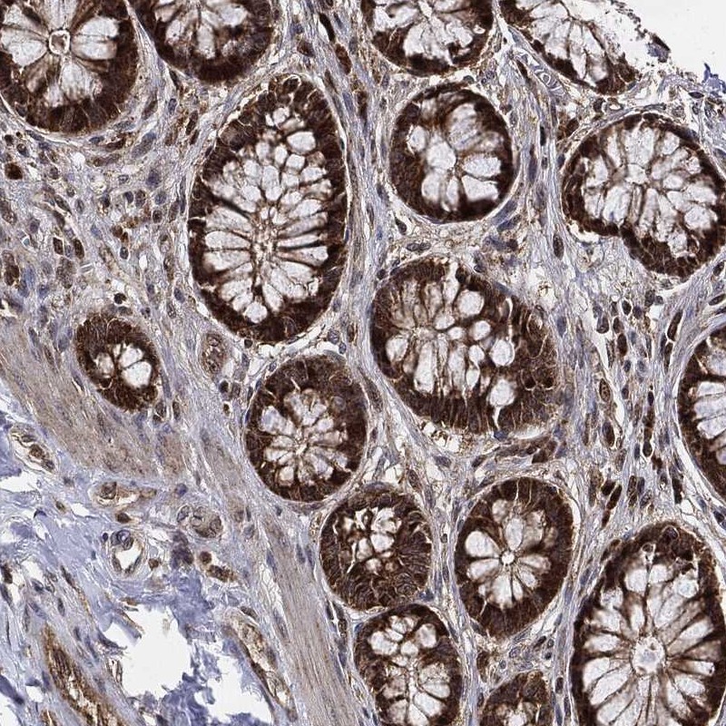 Anti-RNASEL Antibody