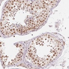 Anti-NXF3 Antibody