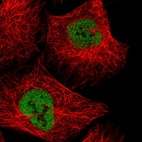 Immunofluorescent staining of human cell line U-2 OS shows localization to nucleoplasm.