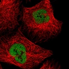 Immunofluorescent staining of human cell line U-2 OS shows localization to nucleoplasm.