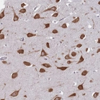 Anti-CCDC124 Antibody