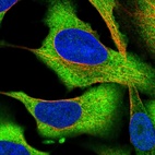 Immunofluorescent staining of human cell line U-2 OS shows localization to plasma membrane & cytosol.