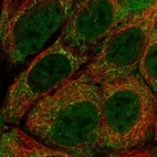 Immunofluorescent staining of human cell line CACO-2 shows localization to nucleoplasm & cytosol.