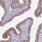 Anti-MRPL54 Antibody
