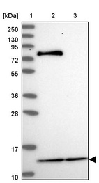 Lane 1: Marker [kDa] 250, 130, 95, 72, 55, 36, 28, 17, 10_br/_Lane 2: Human cell line RT-4_br/_Lane 3: Human cell line U-251MG sp