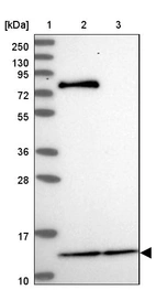 Lane 1: Marker [kDa] 250, 130, 95, 72, 55, 36, 28, 17, 10_br/_Lane 2: Human cell line RT-4_br/_Lane 3: Human cell line U-251MG sp