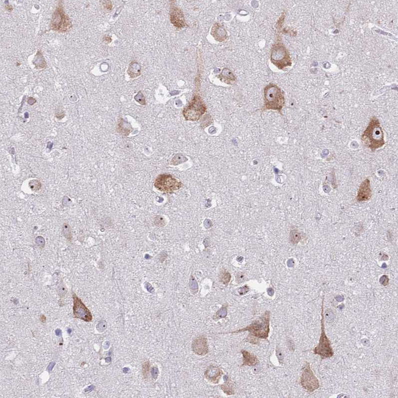 Anti-ST8SIA5 Antibody