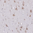 Anti-ST8SIA5 Antibody