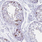 Immunohistochemical staining of human testis shows strong cytoplasmic positivity in cells in seminiferous ducts.