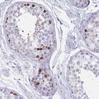 Immunohistochemical staining of human testis shows strong cytoplasmic positivity in cells in seminiferous ducts.