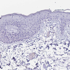 Immunohistochemical staining of human skin shows no positivity in squamous epithelial cells as expected.