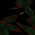 Immunofluorescent staining of human cell line RH-30 shows localization to plasma membrane & midbody.