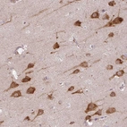 Anti-COX18 Antibody