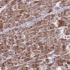 Immunohistochemical staining of human heart muscle shows moderate granular cytoplasmic positivity in cardiomyocytes.