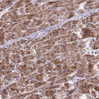 Immunohistochemical staining of human heart muscle shows moderate granular cytoplasmic positivity in cardiomyocytes.