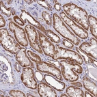 Immunohistochemical staining of human kidney shows moderate granular cytoplasmic positivity in cells in tubules.