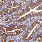 Immunohistochemical staining of human duodenum shows moderate granular cytoplasmic positivity in glandular cells.