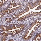 Immunohistochemical staining of human duodenum shows moderate granular cytoplasmic positivity in glandular cells.