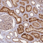 Anti-MRPL49 Antibody