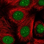 Immunofluorescent staining of human cell line MCF7 shows localization to nucleus & nucleoli fibrillar center.