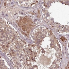 Immunohistochemical staining of human testis shows moderate cytoplasmic positivity in cells in seminiferous ducts.