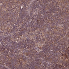 Immunohistochemical staining of human lymph node shows strong cytoplasmic positivity in germinal center cells.