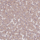 Immunohistochemical staining of human liver shows moderate cytoplasmic positivity in hepatocytes.