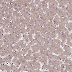 Immunohistochemical staining of human liver shows moderate cytoplasmic positivity in hepatocytes.