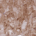 Immunohistochemical staining of human skeletal muscle shows strong cytoplasmic positivity in myocytes.