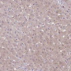Immunohistochemical staining of human liver shows moderate cytoplasmic positivity in hepatocytes.