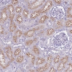 Immunohistochemical staining of human kidney shows strong cytoplasmic positivity in cells in tubules.