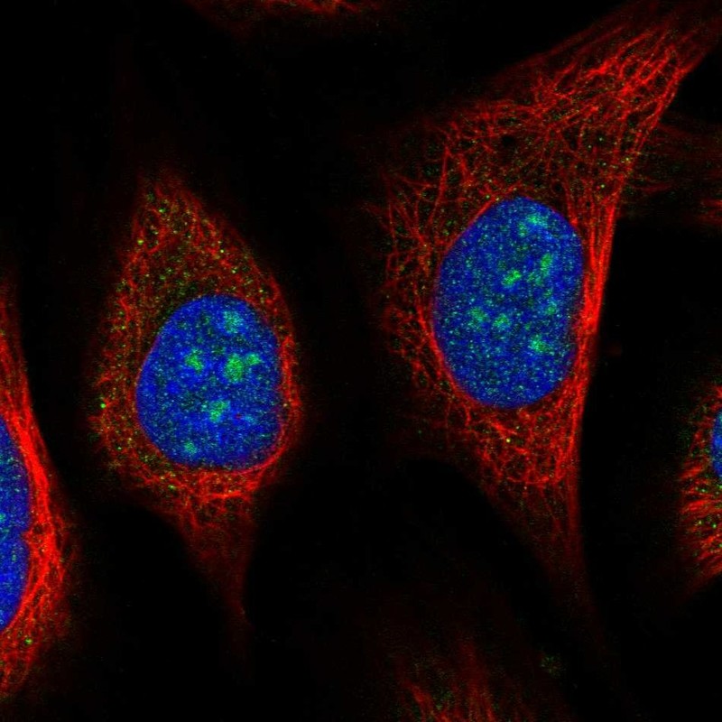 Anti-URB2 Antibody