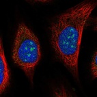 Anti-URB2 Antibody