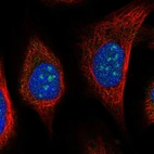 Anti-URB2 Antibody