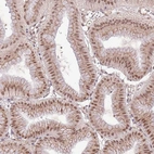 Anti-POLR3H Antibody