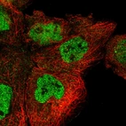 Immunofluorescent staining of human cell line A-431 shows localization to nucleoplasm & centrosome.