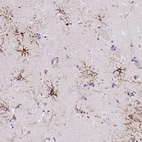 Anti-LRRN3 Antibody