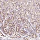 Immunohistochemical staining of human stomach shows moderate granular cytoplasmic positivity in glandular cells.