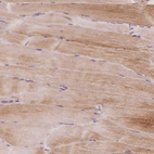 Immunohistochemical staining of human skeletal muscle shows weak cytoplasmic positivity in myocytes.