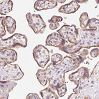 Immunohistochemical staining of human placenta shows moderate granular cytoplasmic positivity in trophoblastic cells.
