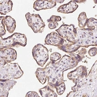 Immunohistochemical staining of human placenta shows moderate granular cytoplasmic positivity in trophoblastic cells.