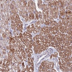 Anti-FBXO27 Antibody